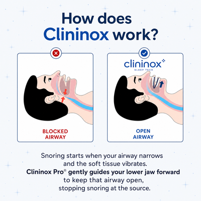 Clininox Pro® Anti-Snoring Mouthpiece